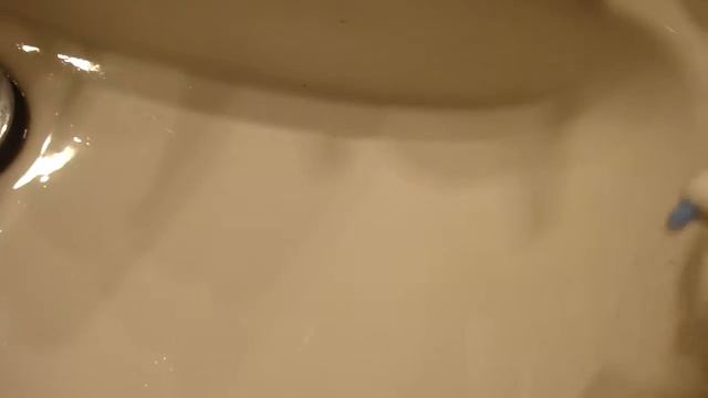 Igiene Dentale a spruzzo acqua e colluttorio. смотреть онлайн
