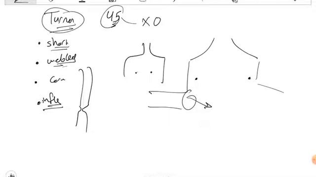 Chromosomal abnormalities (trisomy18,13 -klinefelter -turner) смотреть онлайн