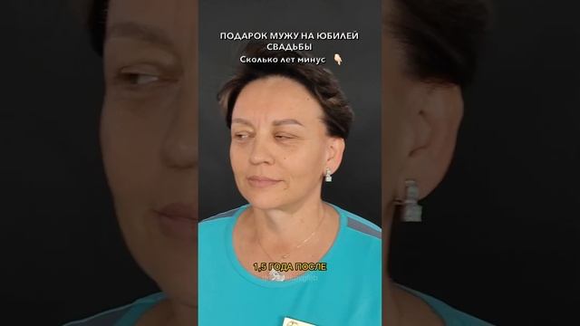 Фейслифтинг. Эндоскопическая подтяжка лба. Нижняя блефаропластика. Доктор ТУМАКОВ Г.И. смотреть онлайн