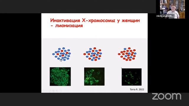 Синдром Альпорта у детей смотреть онлайн