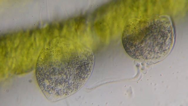 Vorticella Campanula