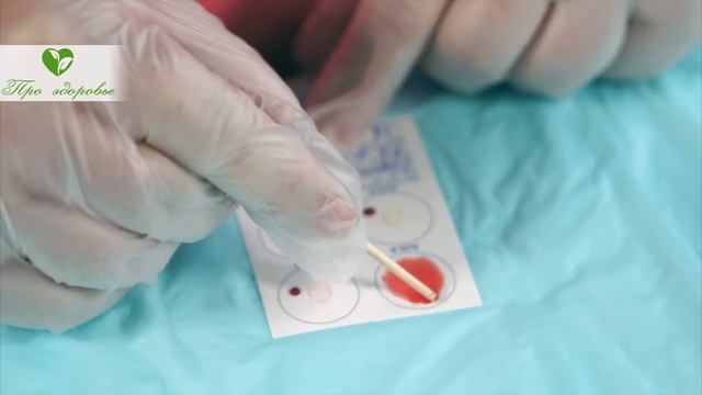 Кровь уже не будет прежней! Смотрите, что вытворяет кофе с качеством крови смотреть онлайн