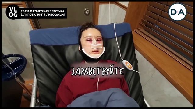 РЕАЛЬНЫЕ ИСТОРИИ ЧО СОН ХВА (ГЛАЗА, РИНОПЛАСТИКА) смотреть онлайн