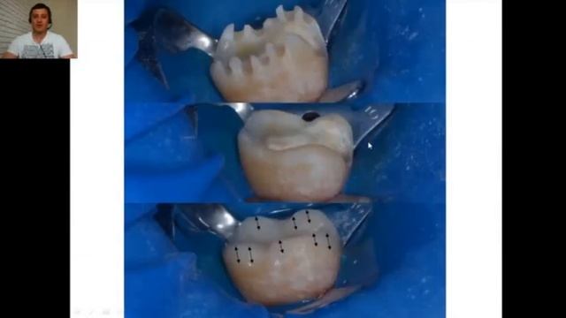 Гордийчук модуль4,урок1 Перекрытие бугров смотреть онлайн