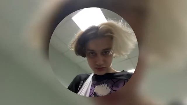 НЕКОГЛАЙ СЛОМАЛ РУКУ