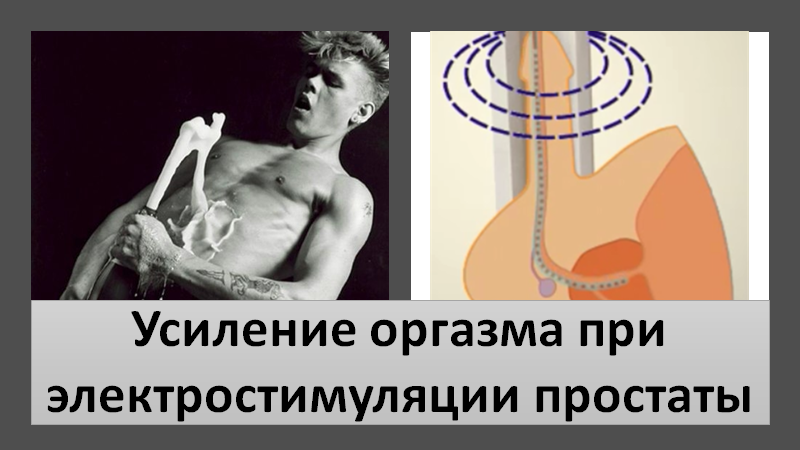 Усиление оргазма при электростимуляции простаты смотреть онлайн