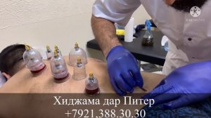Срочно хиджама В Санкт-Петербурге ￼