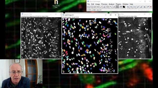 Machine Learning in ImageJ/Fiji - StarDist смотреть онлайн