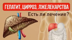 Гепатиты, цирроз печени, болезни печени есть ли лечение? Лжелекарство.
