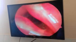 Удаление голосовых связок  у мальтийской болонки эндоскопически