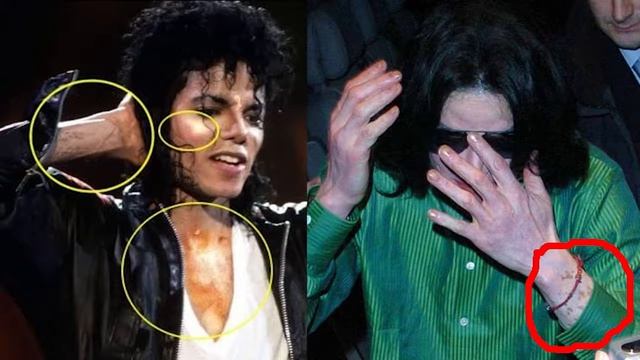 ПОЧЕМУ МАЙКЛ ДЖЕКСОН СТАЛ БЕЛЫМ!!! смотреть онлайн