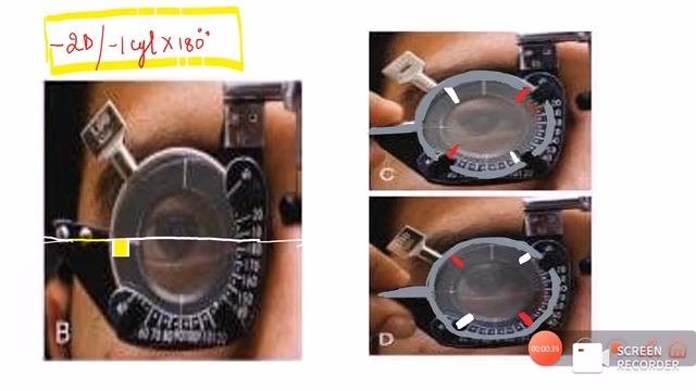 JACKSON CROSS CYLINDER || JCC || TESTING & TECHNIQUE WITH EXAMPLES || REFRACTION SERIES|| смотреть онлайн