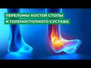 Переломы костей стопы и голеностопного сустава. Особенности лечения и последствия.