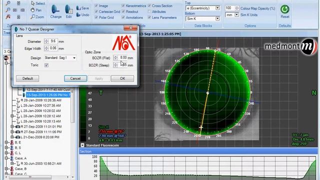 How-To | Fit the No7 Quasar Toric contact lens (Studio 5) смотреть онлайн
