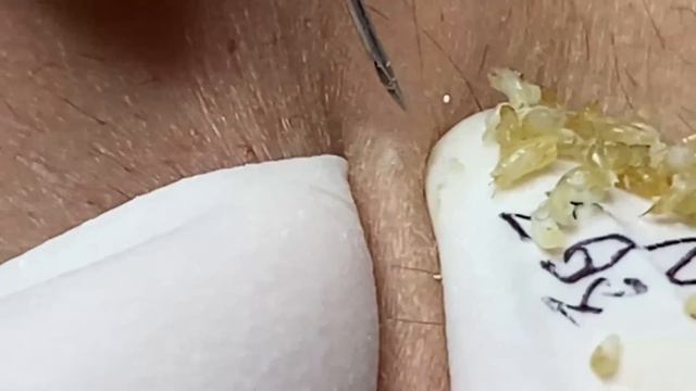 Enjoy Every Day With The Best Video Loan Nguyen Spa Official 2656 смотреть онлайн