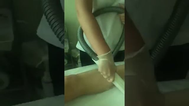 Процедура фотоэпиляции смотреть онлайн