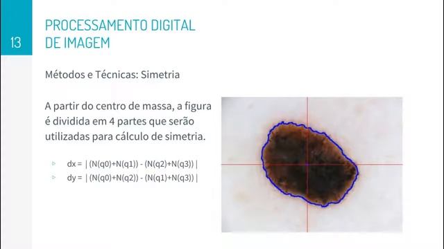 Classificação de Melanoma utilizando PDI e Inteligência Artificial смотреть онлайн