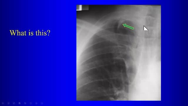 1 Thoracic Radiographic Anatomy and Mediastinal Lines смотреть онлайн