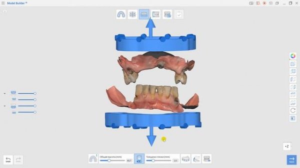 MEDIT LINK СОЗДАНИЕ МОДЕЛИ НА ОСНОВЕ СКАНА | МАСТЕР-КЛАСС ОТ ОЛЕГА ВОЛОВИКОВА | ARTICON