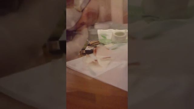 Без анестезии))) смотреть онлайн