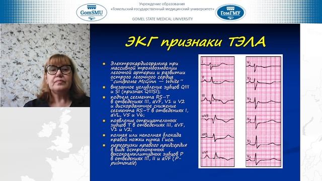 Цырульникова А.Н. Тромбоэмболия легочной артерии смотреть онлайн