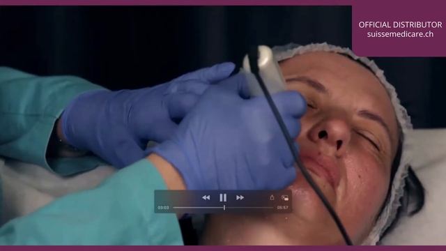 WiQo PRX T33 and MICRONEEDLING Video Tutorial смотреть онлайн