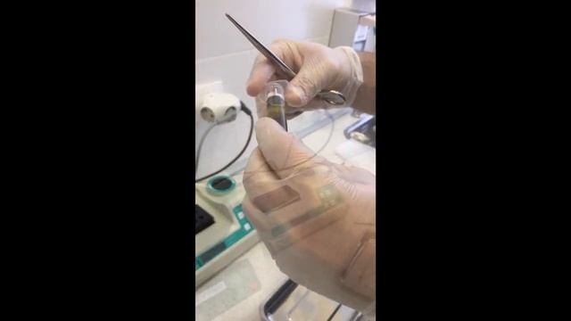 Применение PRF, A-PRF и i-PRF технологии. Получение сгустка в шприце без применения пробирок смотреть онлайн