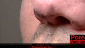 удаление Черных точек