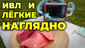 Что порисходит с лёгкими при разных режимах ИВЛ #ПроСМП
