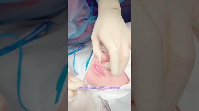 КРАСИВЫЕ ГУБЫ НАВСЕГДА / БУЛХОРН VY-ПЛАСТИКА / #кочнева #абриелль смотреть онлайн