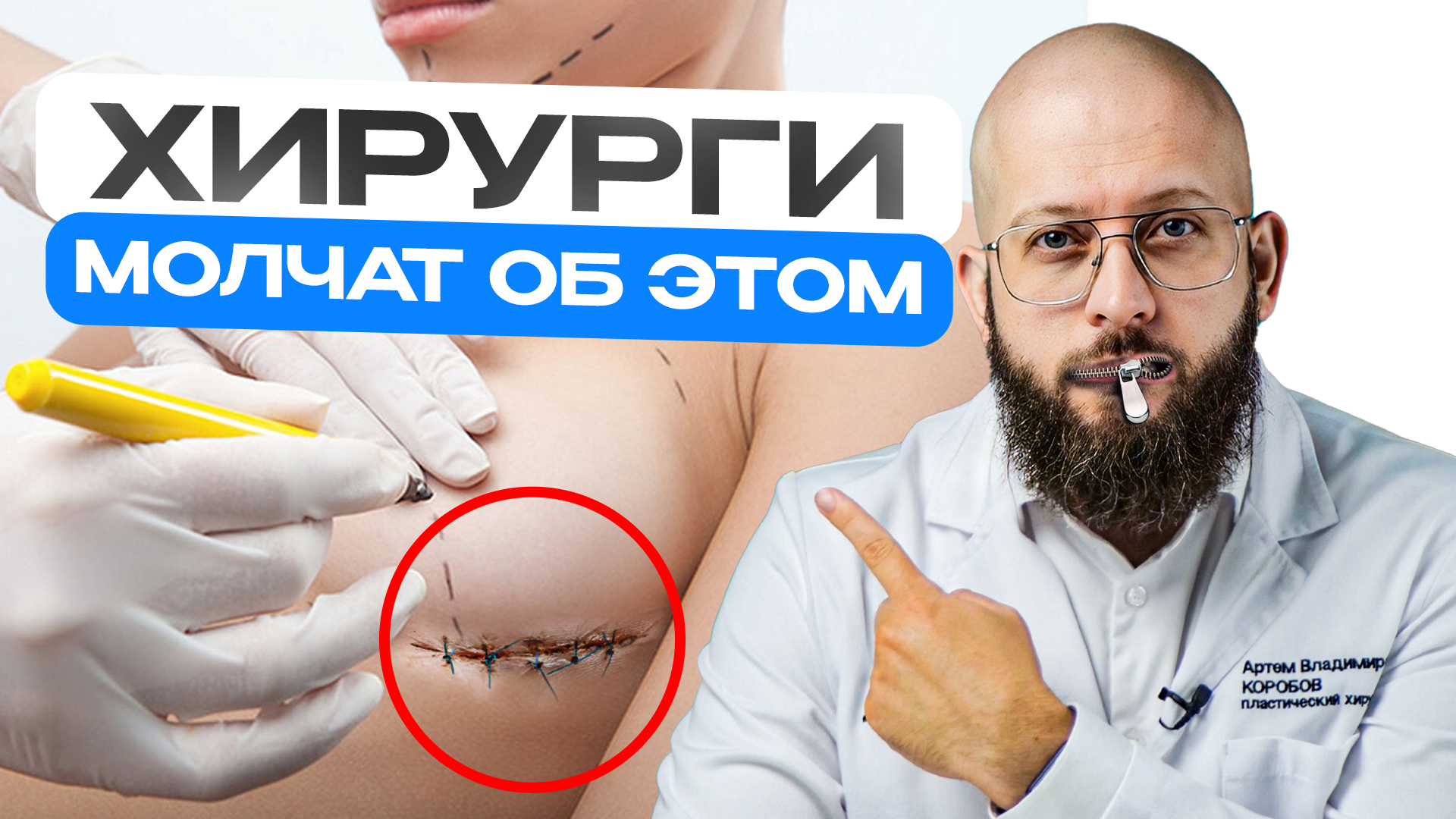 5 ТАБУ в пластической хирургии. ЧТО ОБЯЗАТЕЛЬНО НУЖНО УЗНАТЬ до пластической операции смотреть онлайн