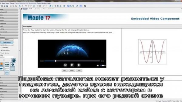 Бактерии Proteus mirabilis в моче