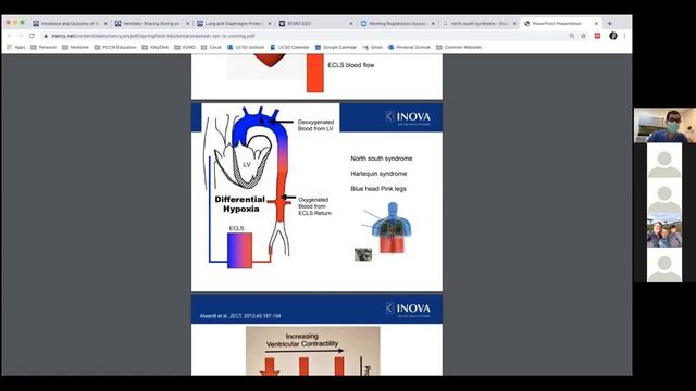 Virtual Boot Camp: ECMO Breakout Session смотреть онлайн