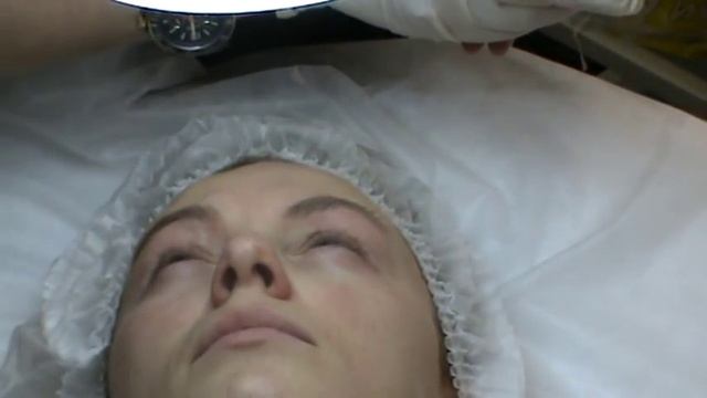 СкинПроджект, пилинг вокруг глаз, обучение смотреть онлайн