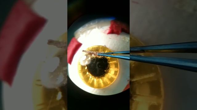 Бревно в глазу