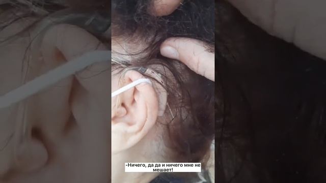 Видео отзыв. Подбор и настройка слухового аппарата смотреть онлайн