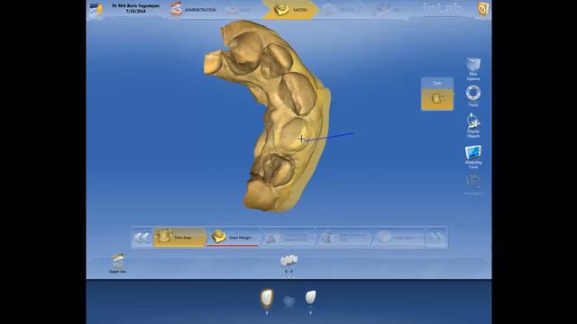 Maryland Bridge in Russian,CEREC InLab 4.2.5 смотреть онлайн