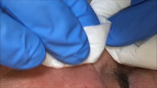 Skin treatments on a wonderful lady: Deep cleanse of the nose смотреть онлайн