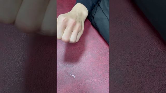 L хондрома пальца смотреть онлайн