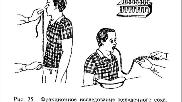 Уход-10: Уход при заболеваниях пищеварительной системы смотреть онлайн