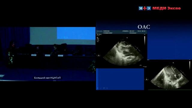Лекция "Особенности ультразвуково диагностики ВПС у детей первых дней жизни" смотреть онлайн