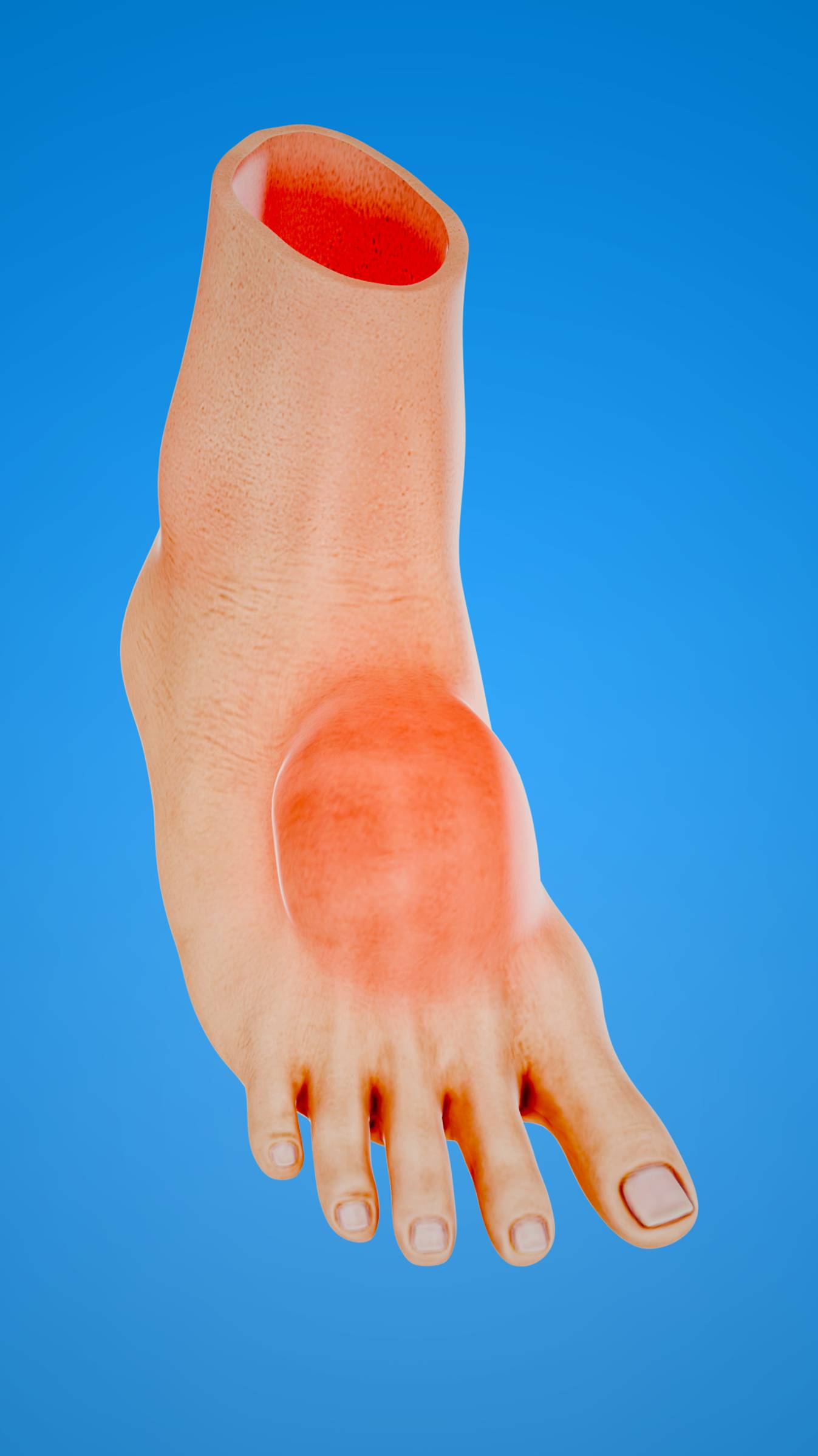 Надо ли протыкать волдыри? 💦