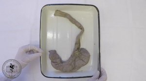 Спланхнология, анатомия пищевода