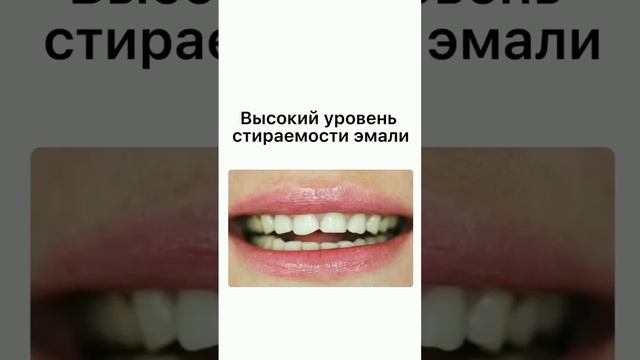 В каких случаях виниры обязательны ⬆️⬆️⬆️  | InSmile | Глеб Пекли