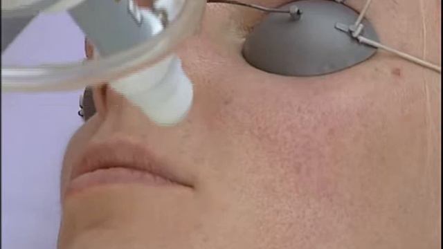 Лечение жирной кожи, сужение пор смотреть онлайн