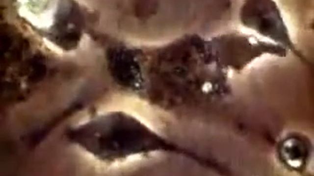 Т-лимфоциты смотреть онлайн