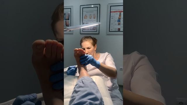 Лечение микоза стоп - Подолог