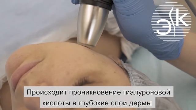 Лазерная биоревитализация смотреть онлайн