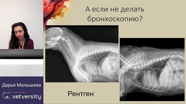 Зачем врач просит провести БАЛ при заболевании легких? Насколько он необходим? смотреть онлайн