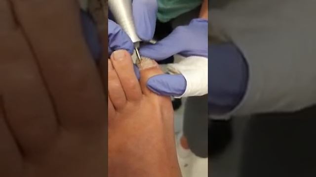 Препаратный педикюр смотреть онлайн